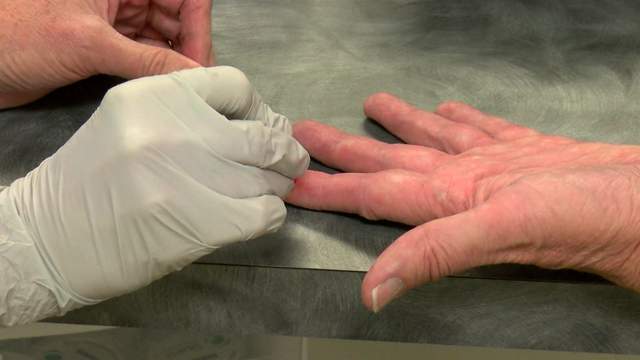 Coronavirus Miami Beach Urgent Care Now Offers Antibody Testing