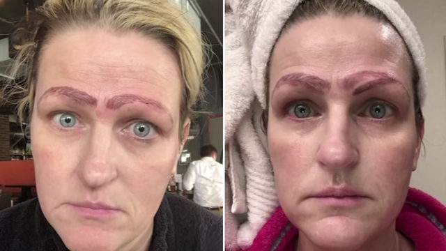 Woman Left With 4 Eyebrows After Botched Microblading