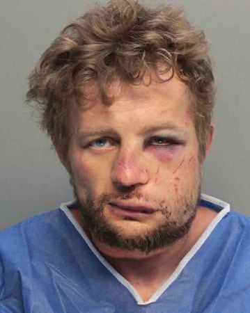 Mark Katsnelson, 35, was treated for his injuries at a hospital after the victim he is alleged to have randomly attacked fought back.