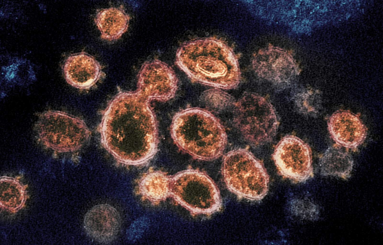 Florida reports first case of coronavirus with most infectious British strain