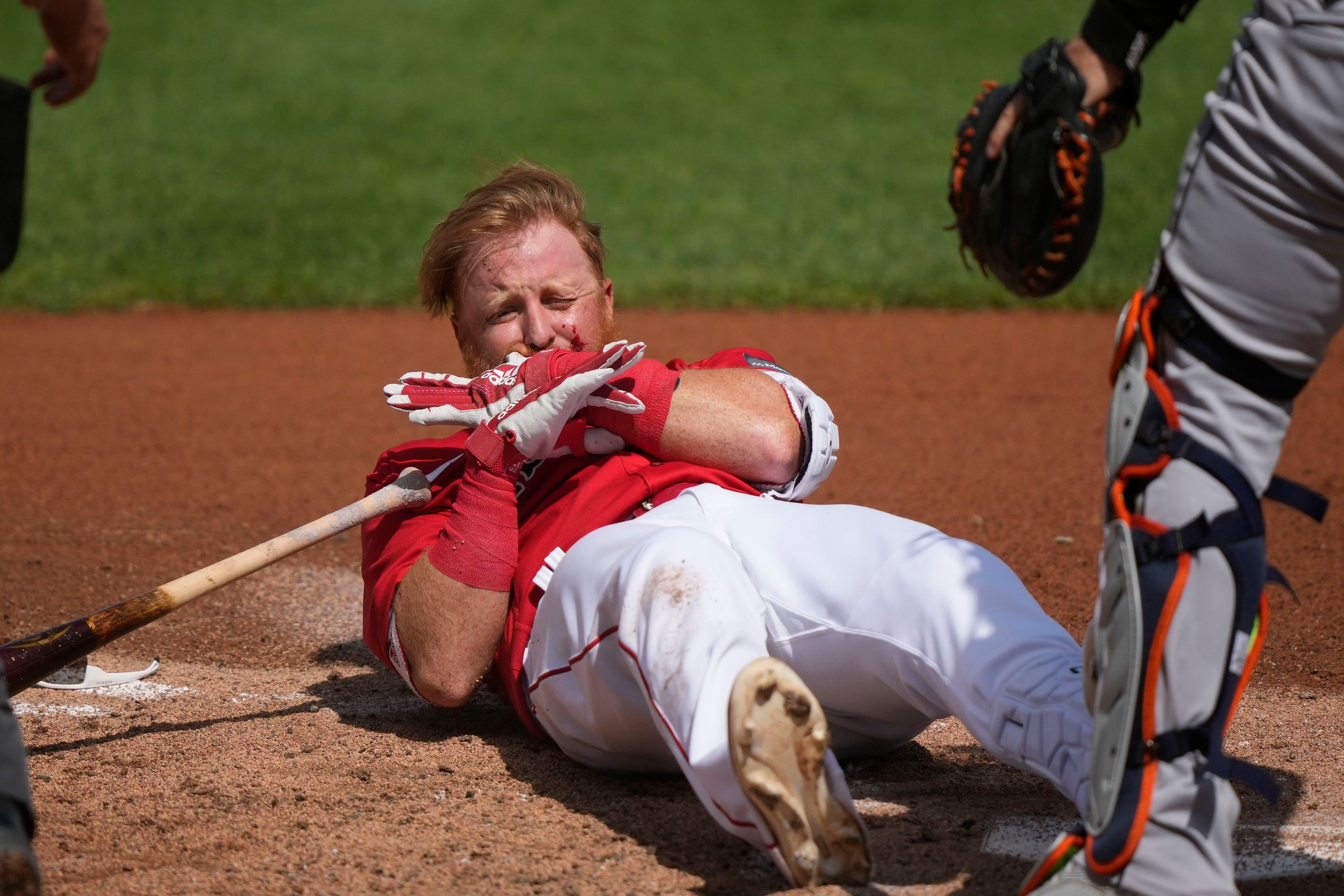 Red Sox Give Update On Justin Turner After Taking Pitch To Face