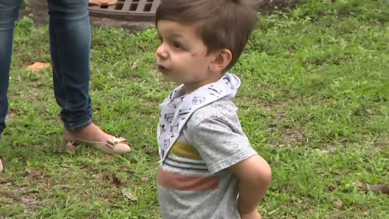 Dog attacks 2-year-old and father in popular Miami park