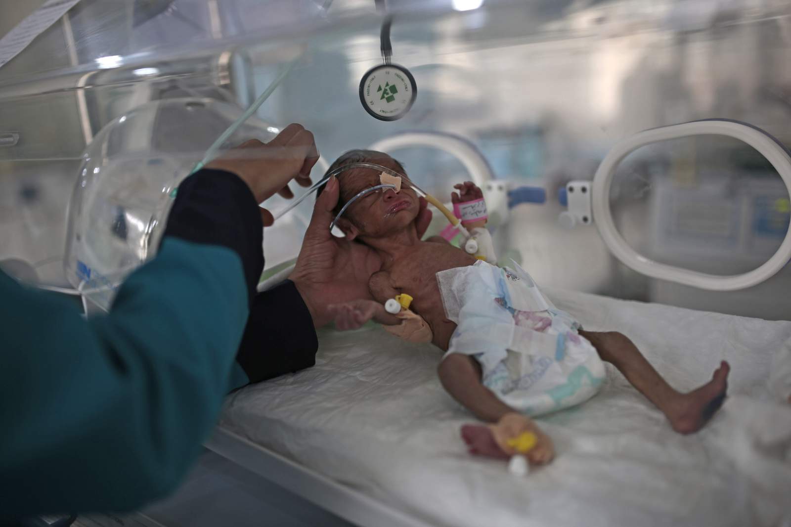 UN: Over 2 million Yemeni children may starve in 2021