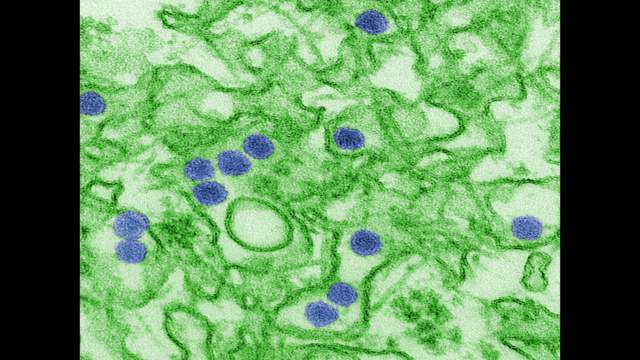 Zika virus can remain in sperm for 6 months
