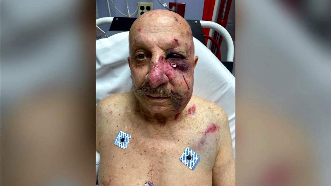 Victim of brutal attack on Metromover seeks damages from security contractor Allied Universal