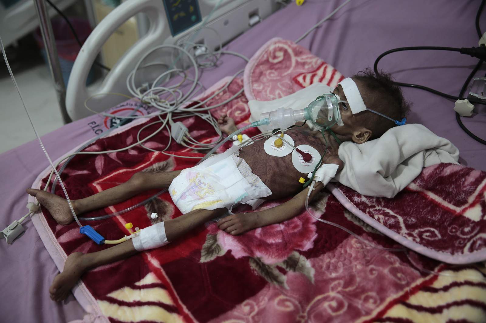 UN warns COVID-19 is `roaring back' as Yemen faces famine