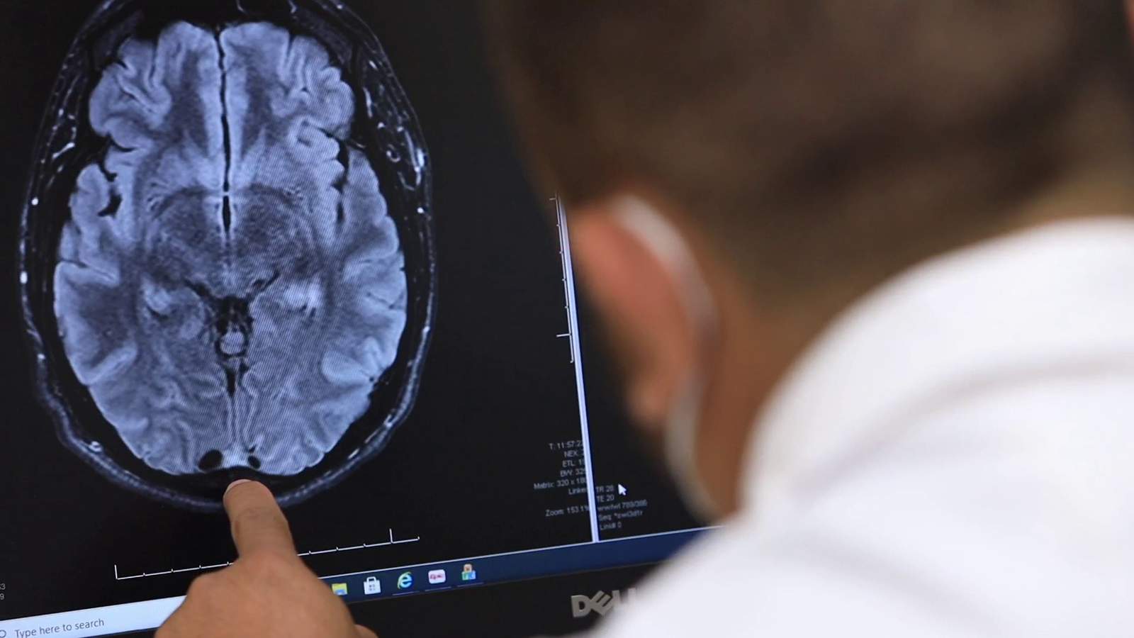 Concussion Clinic Neurologists Help Patients Play Again
