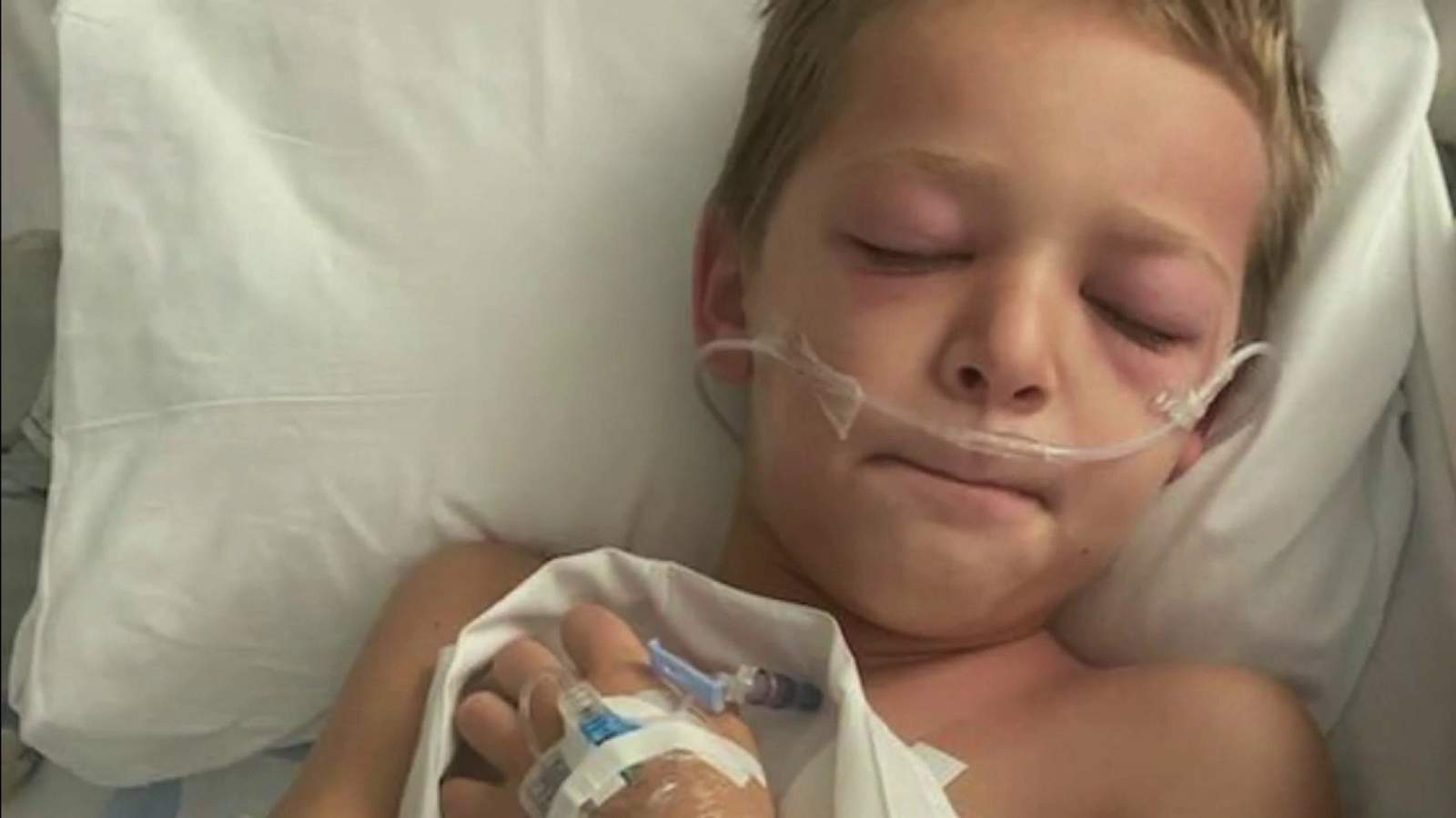 8-year-old Florida Keys boy hospitalized with illness caused by COVID