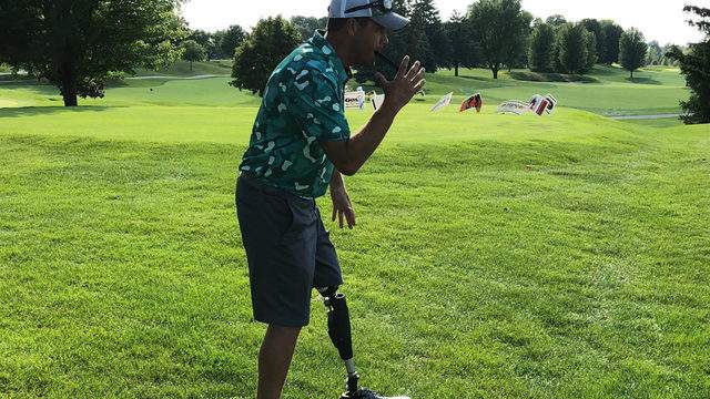 'Playing through' adversity: 'I'm lucky I'm alive and only lost two legs'