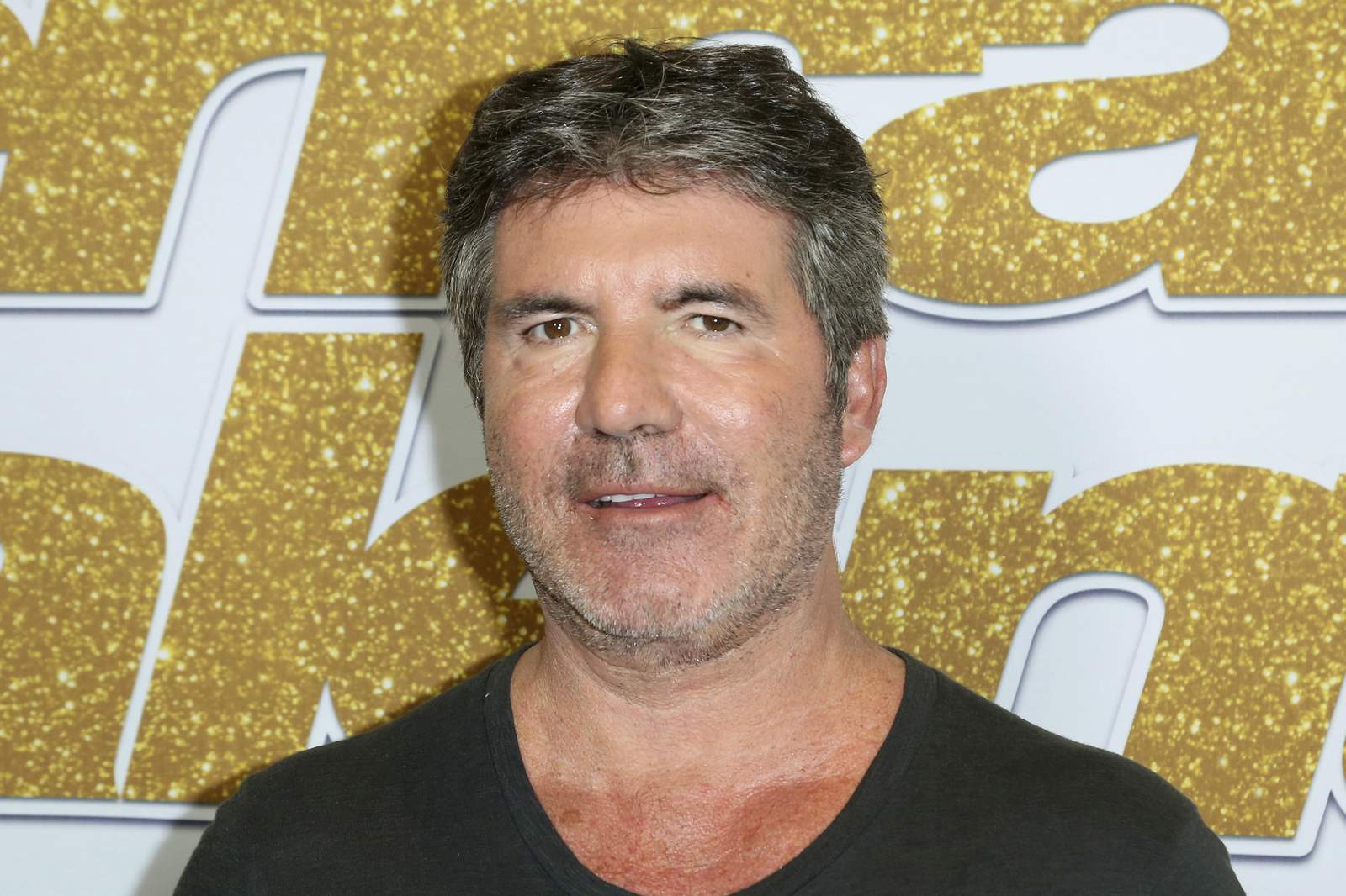 Simon Cowell injures back while testing electric bicycle