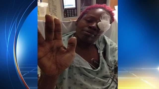 Man stuck knife in woman's eye during attack at Weaver ...