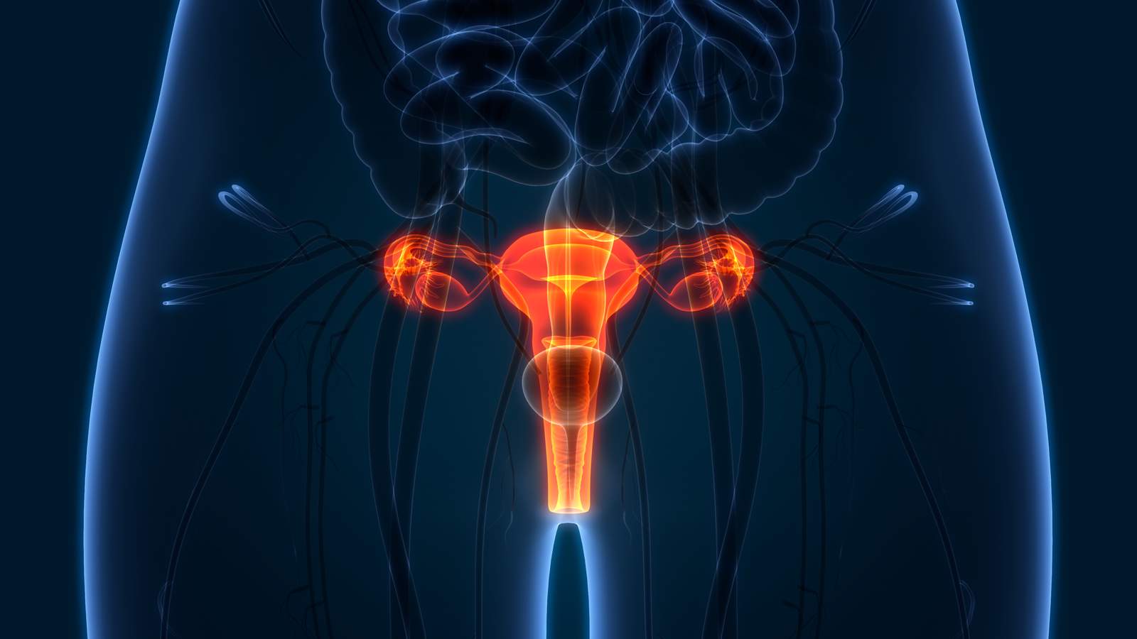 Ovarian cancer -- or is it?