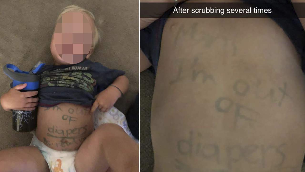 Florida day care writes on child’s tummy to remind mother to bring diapers