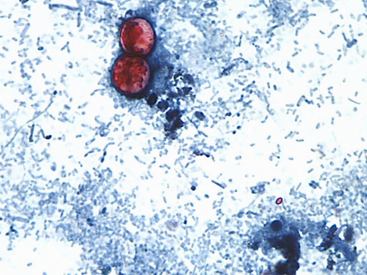 Image linked from the original feed: Michigan reports the first 2 US deaths related to a diarrhea-causing parasite