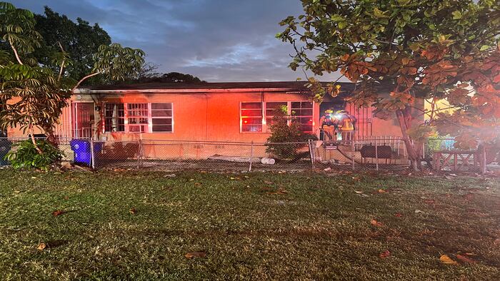 Arson investigation underway after Miami man suffers burns in duplex fire