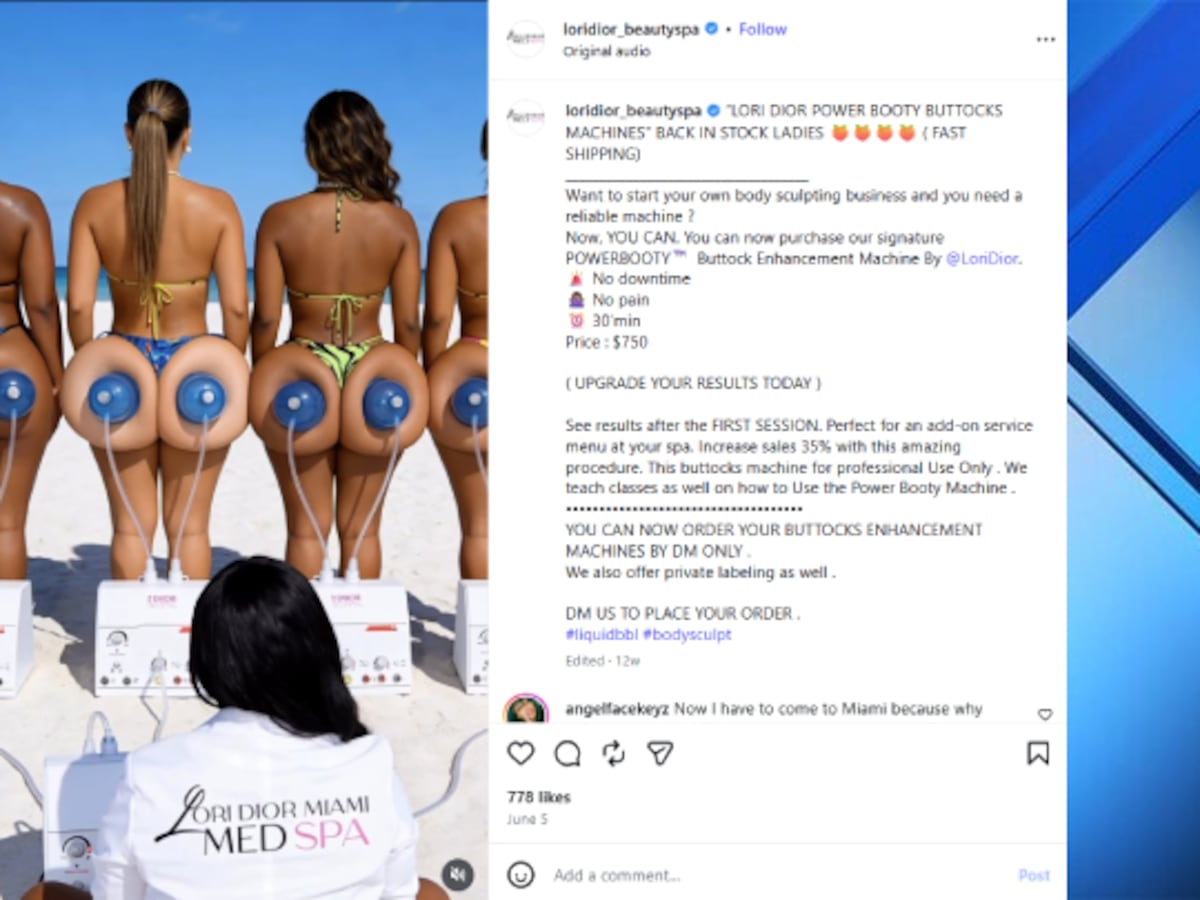 Miami Woman Arrested for Allegedly Operating Unlicensed Clinic, Performing Illegal Butt Sculpting