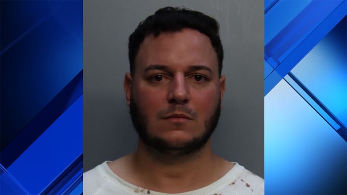 Man attacks victim with glass, metal bottles after hurling racial slurs at him in North Miami Beach, police say